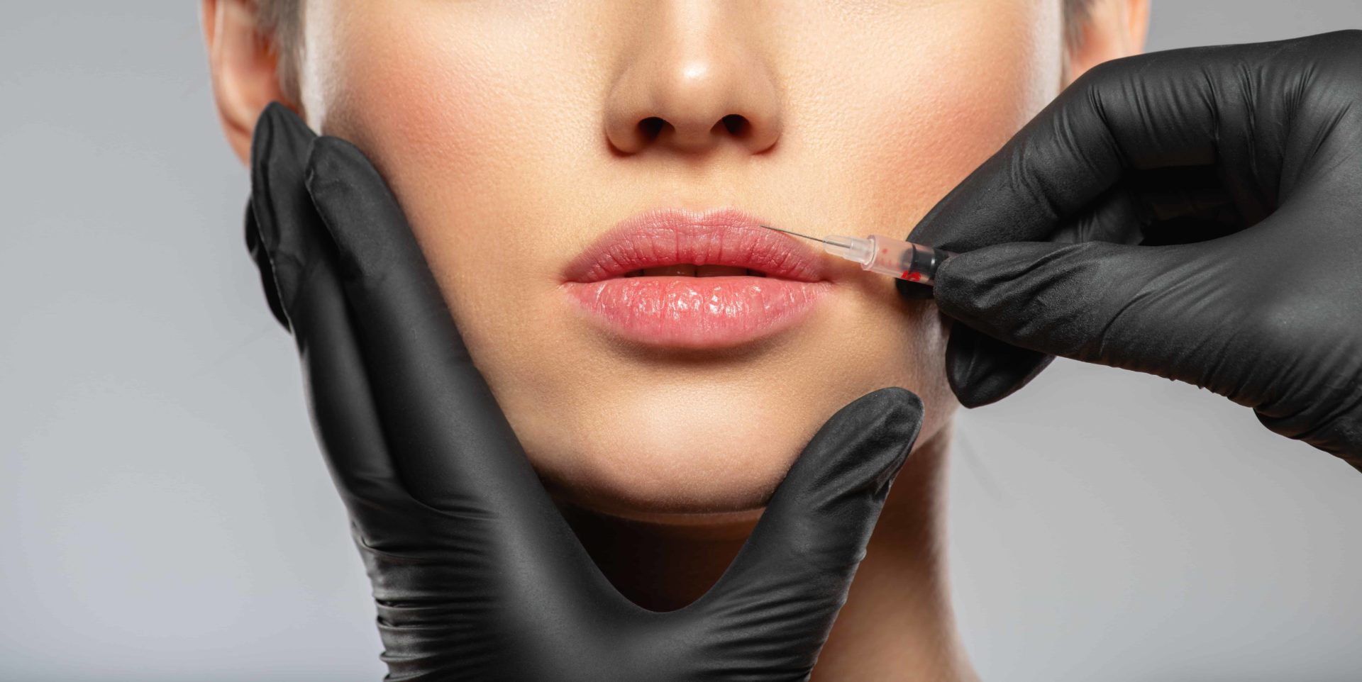 How Long Do Dermal Fillers Last Managing Expectations